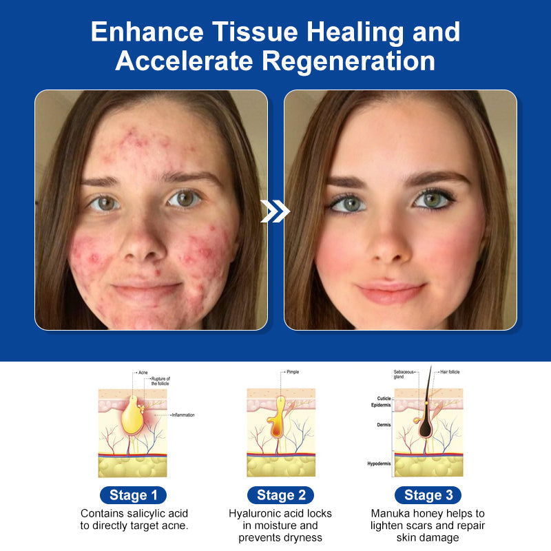Royal Jelly Skin Treatment Cream (AAD Recommended👨⚕️)💖💟