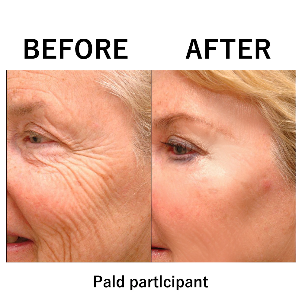 🔥 Last Day Discount: 87% OFF 🌸Instant Face Tightener