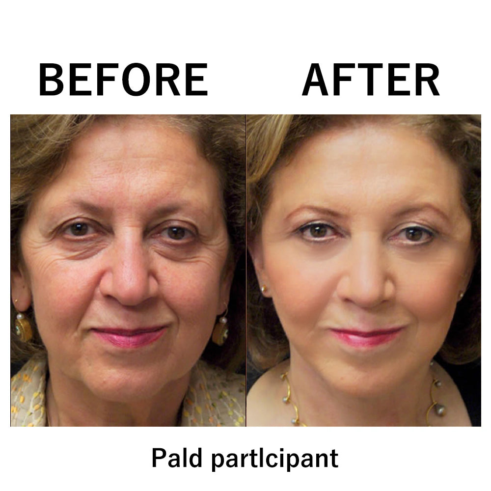 🔥 Last Day Discount: 87% OFF 🌸Instant Face Tightener