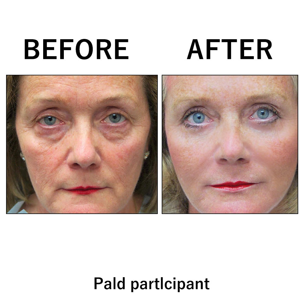 🔥 Last Day Discount: 87% OFF 🌸Instant Face Tightener