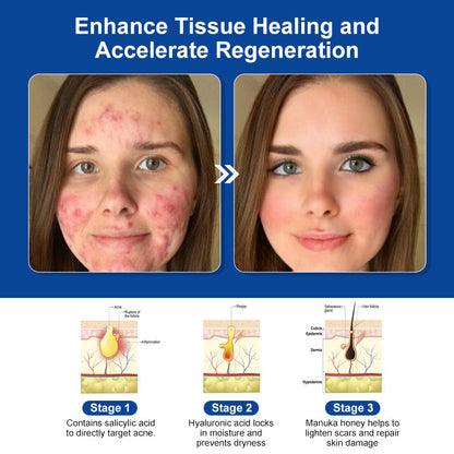 Royal Jelly Skin Treatment Cream (AAD Recommended👨‍⚕️)💖💟