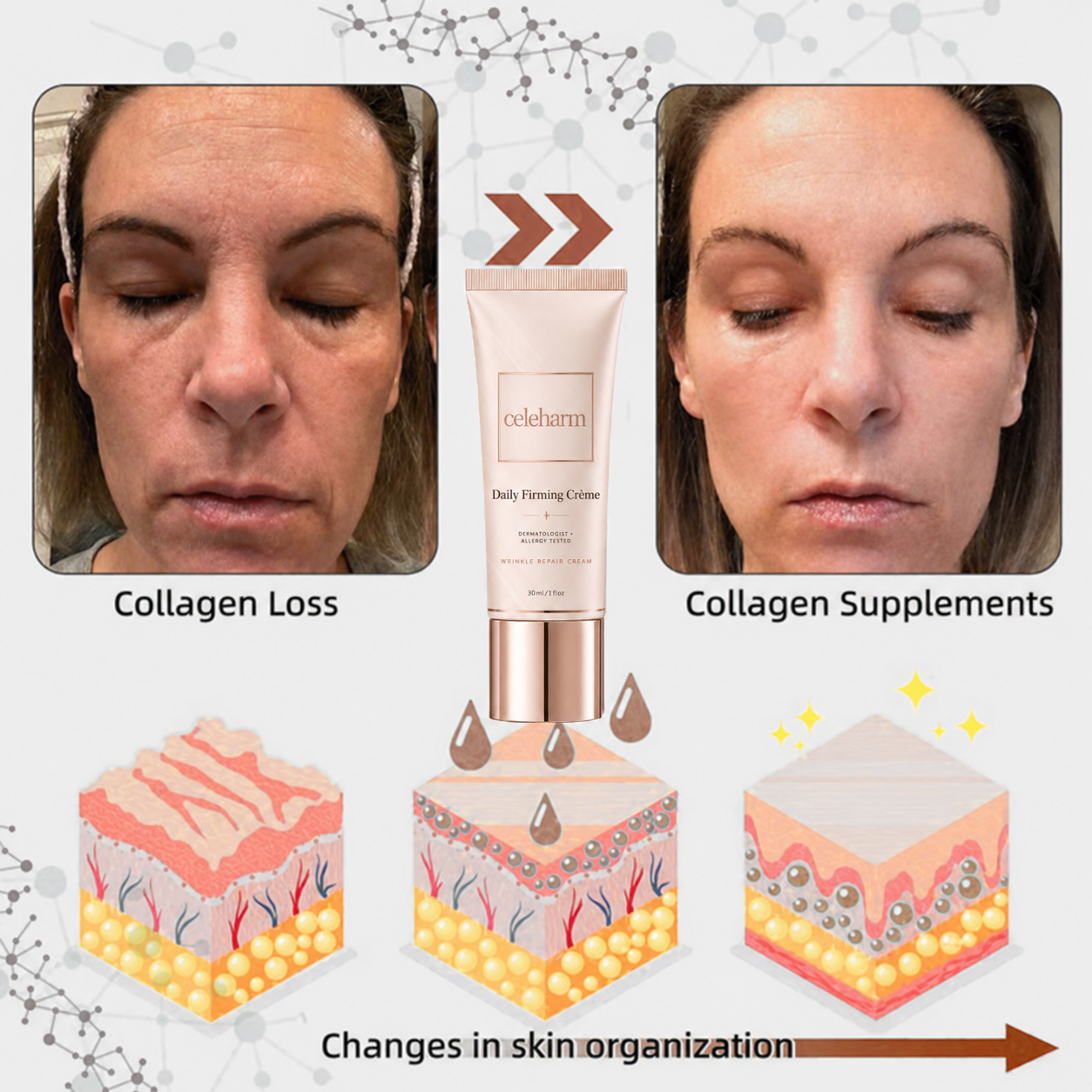 Last Day Discount: 87% OFF 🌸 Second Gen Instant Wrinkle Eraser 🌟